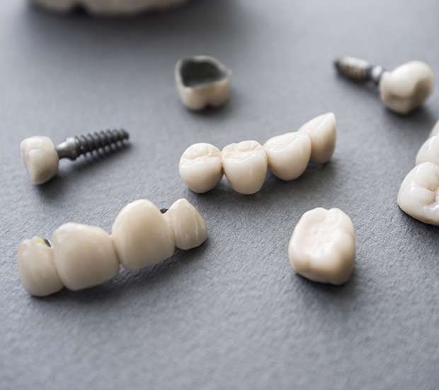 Dental Implants and Mini Dental Implants